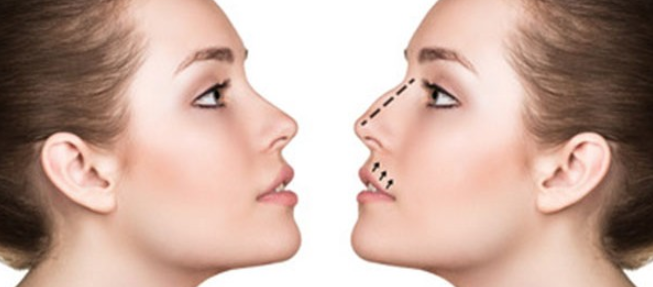 Image result for Rhinoplasty Surgeon